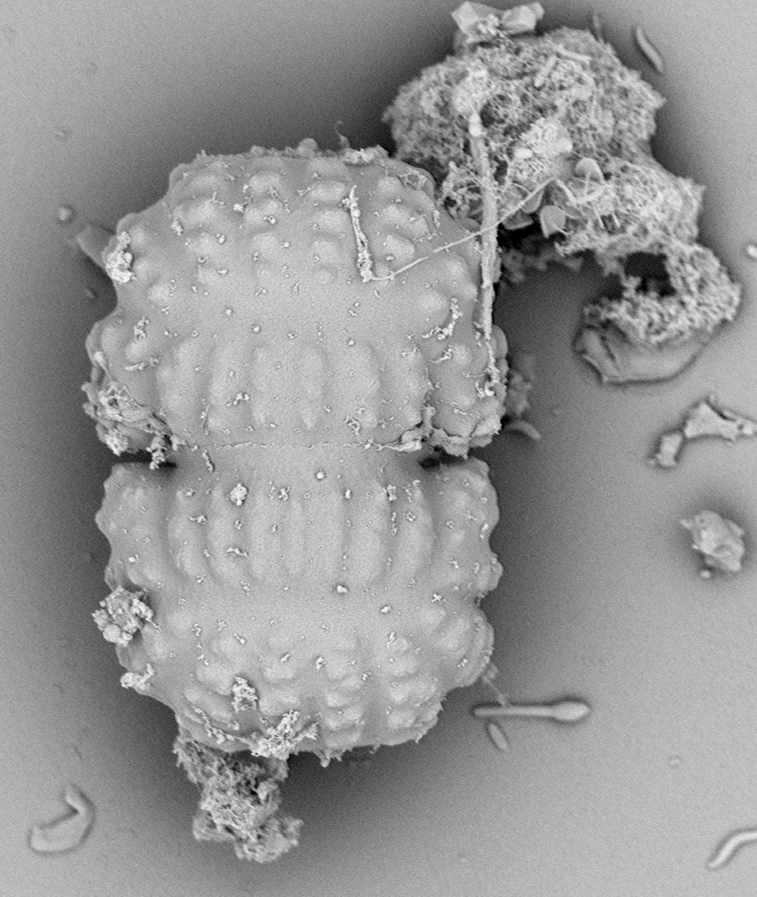 Cosmarium crenatoides
